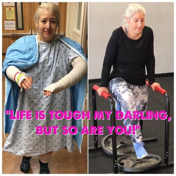 Jacqueline Adan bắt đầu cắt phần da tay và thân trên.