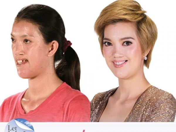 Phẫu thuật thẩm mỹ đã thay đổi số phận một người như thế nào? ảnh 3