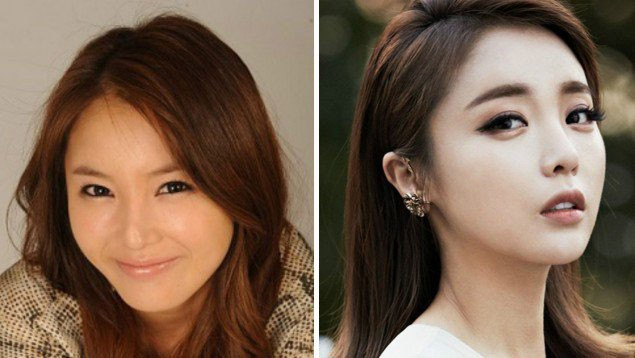 Hong Jin-young trước và sau phẫu thuật thẩm mỹ .