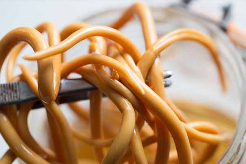 Giun đũa gây 2.700 ca tử vong mỗi năm.