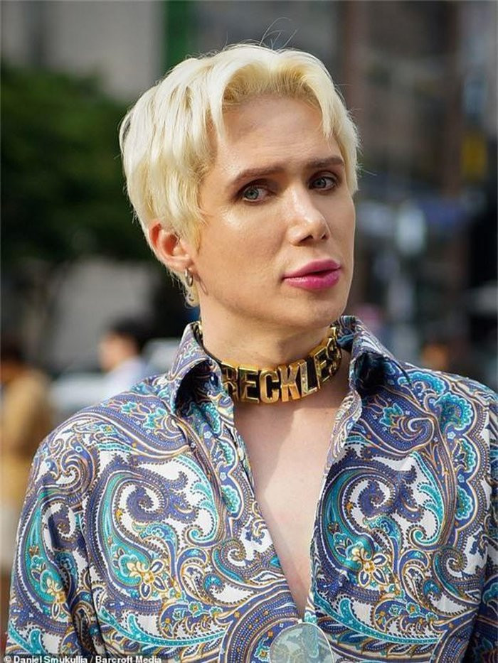 Hình ảnh về Oli London, người đã bỏ ra hàng tỷ đồng và trải qua hơn 15 cuộc phẫu thuật thẩm mỹ để có gương mặt giống với thành viên Jimin của BTS. (Ảnh: Daniel Smukullia/Barcroft Media)