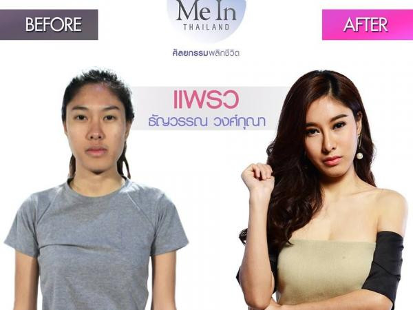 Phẫu thuật thẩm mỹ đã thay đổi số phận một người như thế nào? ảnh 2