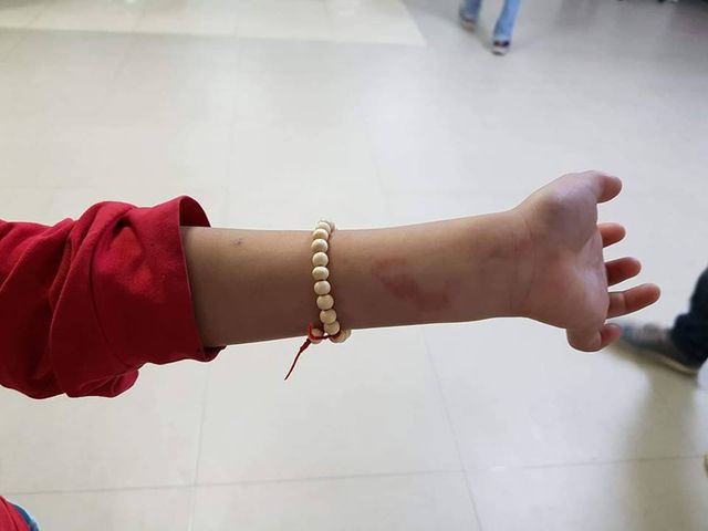 Học sinh lớp 2 bị cô giáo đánh vì không làm bài tập.