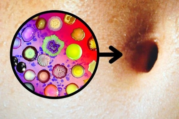 Gần 2400 loài vi khuẩn được phát hiện trong rốn