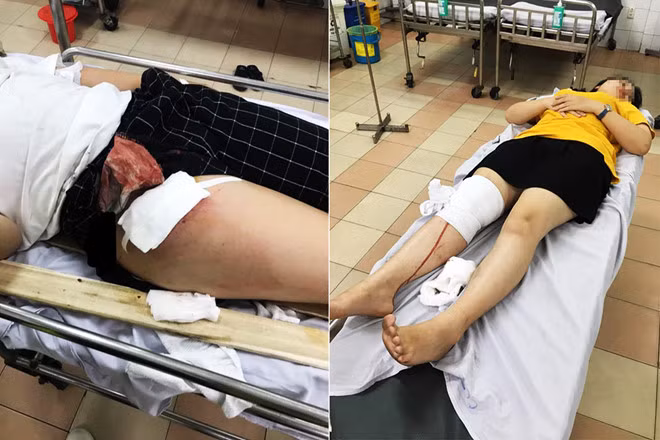 Hai nữ sinh viên Trường đại học Công nghệ TP.HCM bị thương nặng. ẢNH: NHÂN VẬT CUNG CẤP.