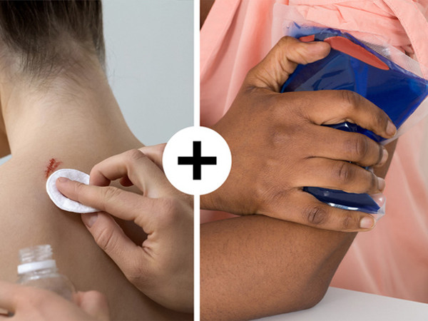 Một vài mẹo sơ cứu ban đầu bạn nên biết ảnh 2