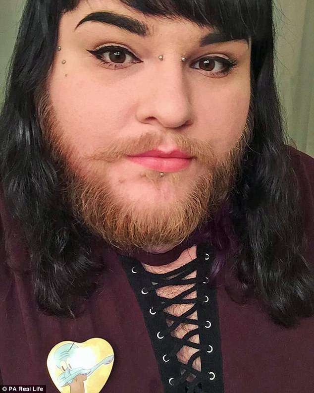 Cô Nova Galaxia (26 tuổi) muốn kể câu chuyện của mình để giúp đỡ những người khác cũng đang gặp cùng vấn đề.