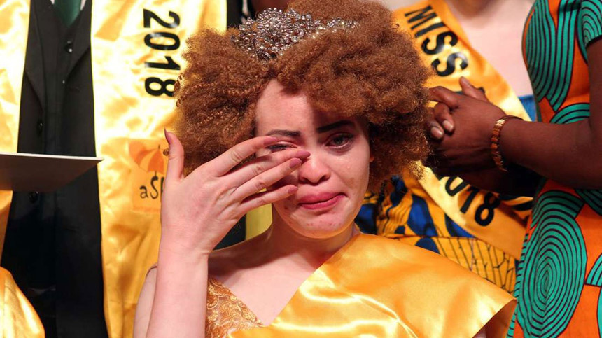 Ảnh: Dennis Onsongo.