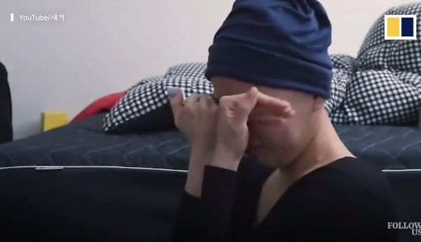 Sau đó, tóc cô nhanh chóng bị rụng. Càng ngày càng nhiều. Đến mức bạn trai cô đã phải thay ga giường màu tối để ”che giấu” những đoạn tóc này.