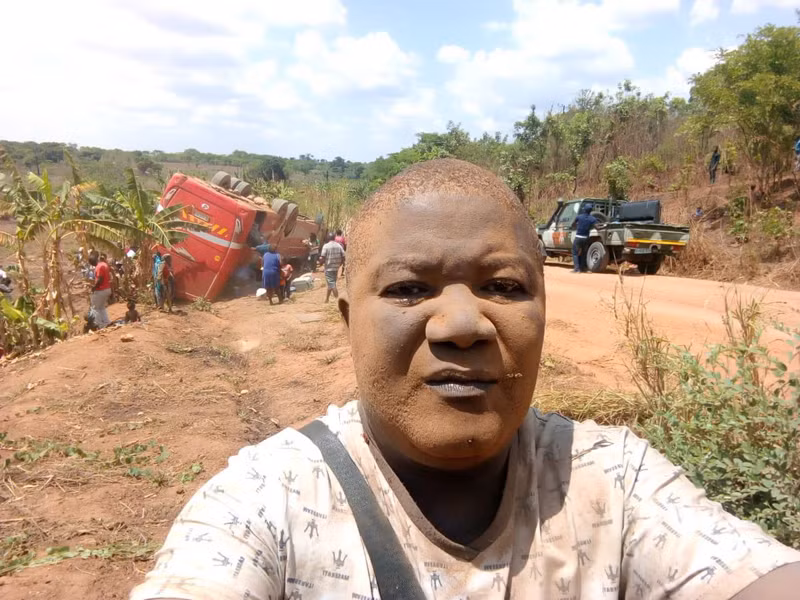 Còn đây là tấm ảnh selfie chụp sau khi tai nạn.