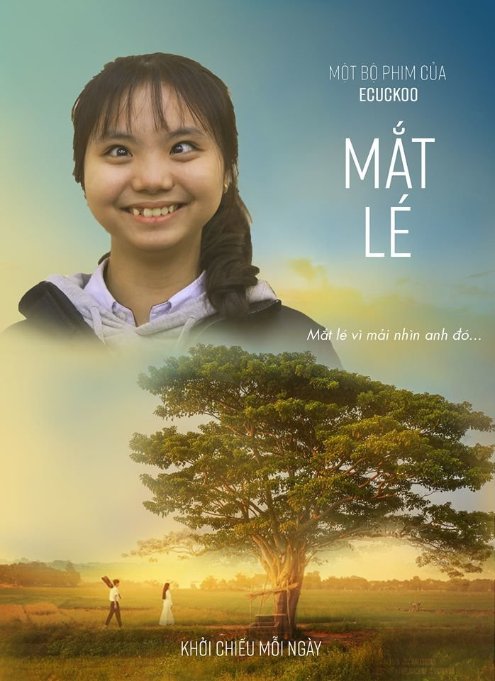 Mắt lé…vì mải nhìn anh đó.