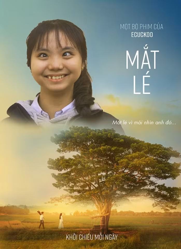 Mắt lé…vì mải nhìn anh đó.
