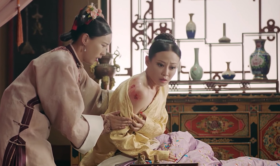 Ngụy Anh Lạc chỉ muốn làm Cao Quý phi bị bỏng.