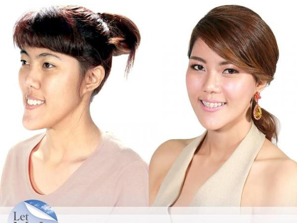 Phẫu thuật thẩm mỹ đã thay đổi số phận một người như thế nào? ảnh 4