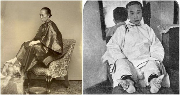 Tục bó chân ở Trung Quốc gần như đã trở thành một nét truyền thống của phụ nữ đất nước này trong suốt thời phong kiến.