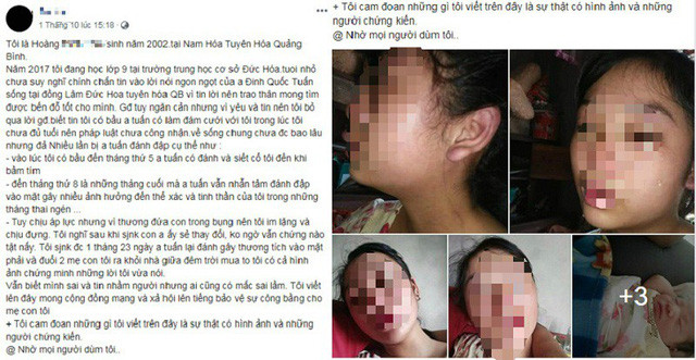 Bà mẹ 16 tuổi đăng đàn cầu cứu vì bị chồng bạo hành.