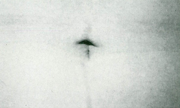 Hình dạng rốn được cho là đẹp nhất.