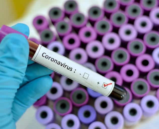 Nhóm các nhà khoa học ở Australia cho biết đã phát triển thành công phiên bản virus corona mới trong phòng thí nghiệm, lần đầu tiên được tái tạo bên ngoài Trung Quốc, trong bước đột phá có thể giúp nhanh chóng tạo ra vắc-xin. Ảnh: Getty. Nhóm các nhà khoa học ở Australia cho biết đã phát triển thành công phiên bản virus corona mới trong phòng thí nghiệm, lần đầu tiên được tái tạo bên ngoài Trung Quốc, trong bước đột phá có thể giúp nhanh chóng tạo ra vắc-xin. Ảnh: Getty.