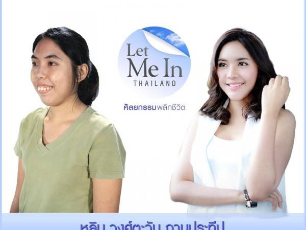 Phẫu thuật thẩm mỹ đã thay đổi số phận một người như thế nào? ảnh 1