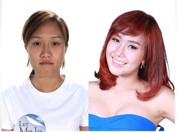 Phẫu thuật thẩm mỹ đã thay đổi số phận một người như thế nào? ảnh 13