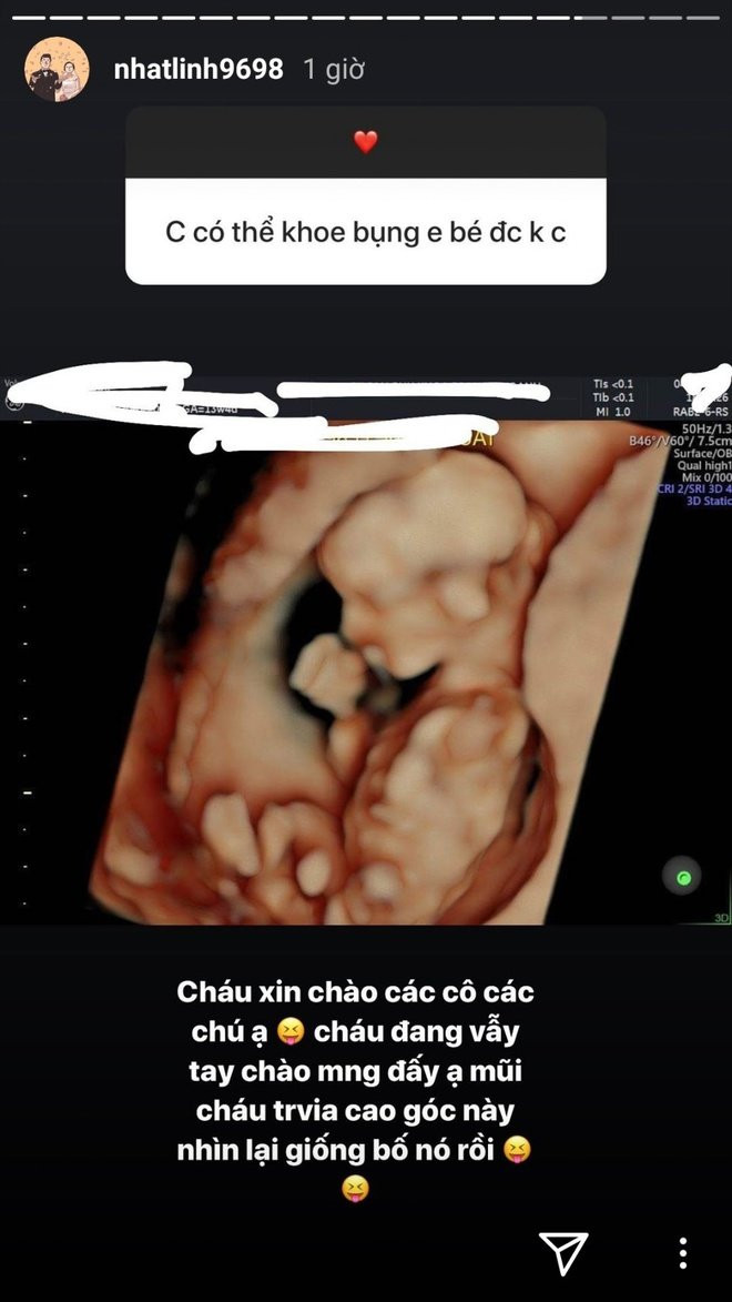 Ảnh siêu âm con đầu lòng của vợ chồng Phan Văn Đức.