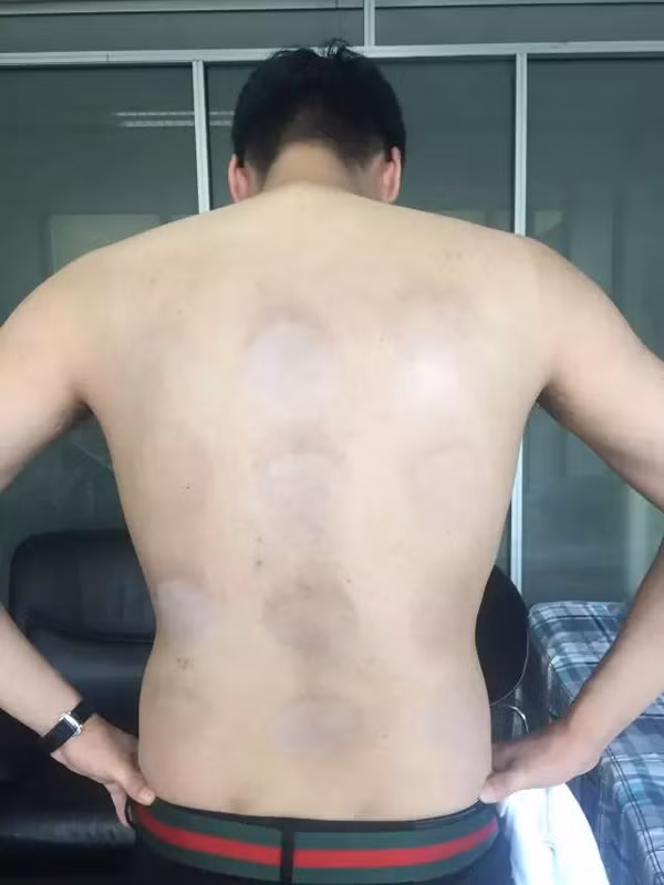 Kết quả mà chàng trai thu được sau khi thử tác dụng của 12 loại kem chống nắng khiến nhiều người ngỡ ngàng.