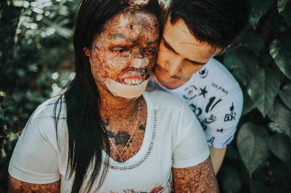 Bạn có bao giờ nghĩ đến chuyện từ bỏ một tình yêu đẹp chỉ vì ngoại hình?