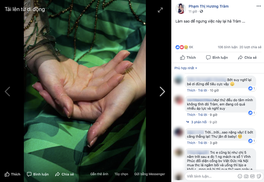 Hình ảnh đôi bàn bong tróc của nữ ca sĩ khiến các fan lẫn bạn bè không khỏi lo lắng.