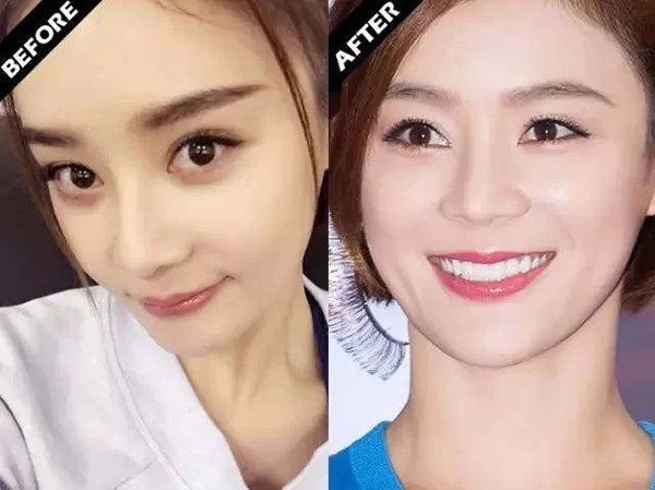 Viên San San đúng là 