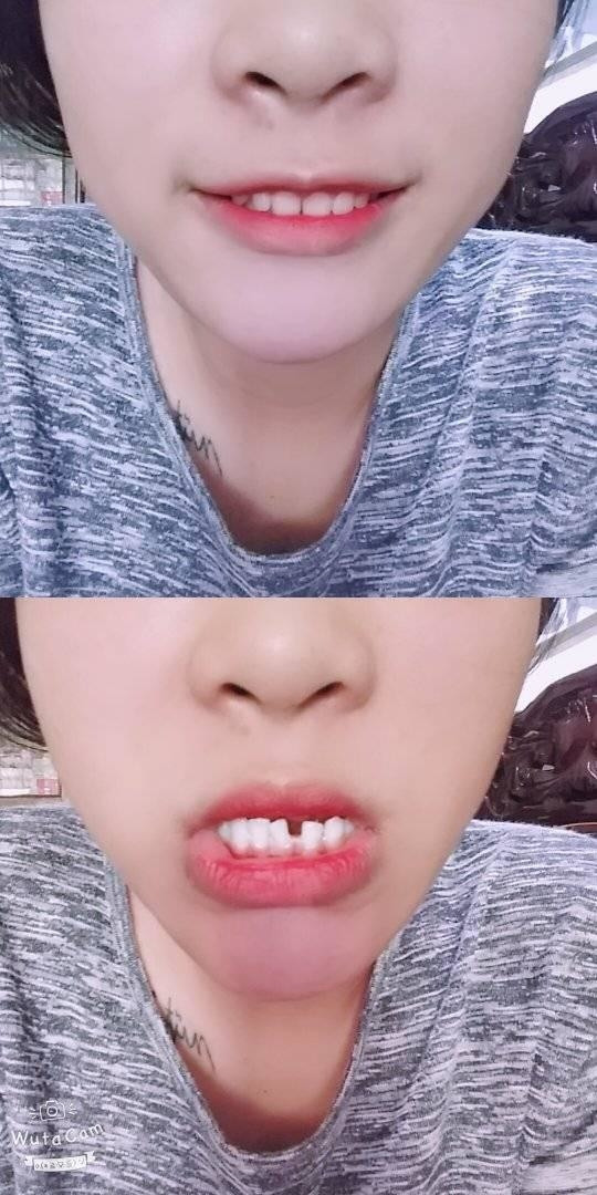 "Và ông trời cho tao răng nhưng không cho chúng... chạm vào nhau".