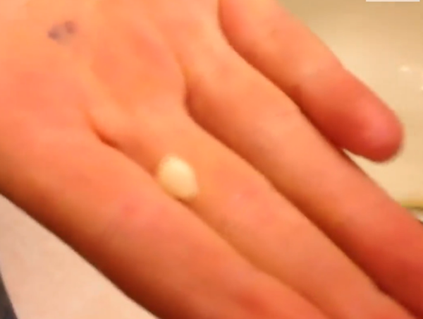 Nhiệm cụ đã hoàn thành. Chiếc răng đã nhổ được rồi.