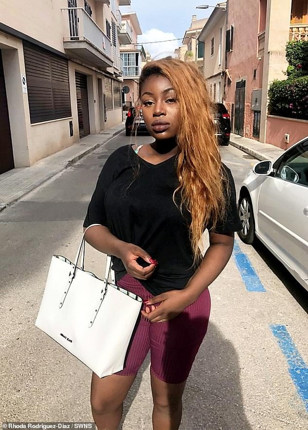 Nữ sinh mắc căn bệnh lạ hiếm gặp.