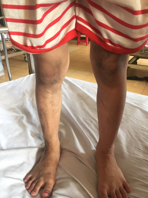 Các cháu vào viện trong tình trạng lem luốc, hoảng hốt do khói cháy. ẢNH: C.T.V.