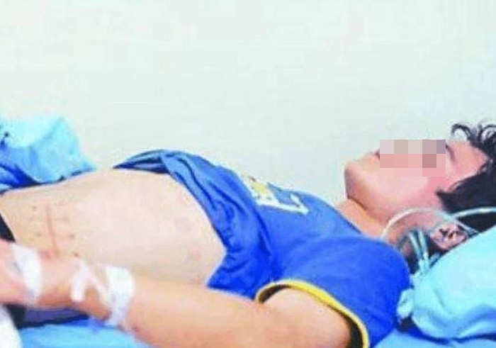 Anh chàng sau đó đã phải trả giá bằng cả phần đời còn lại cho hành động dại dột của mình.