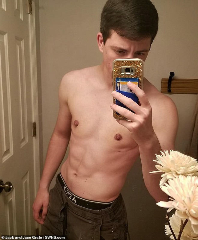 "Chị em" song sinh cùng chuyển giới trở thành "anh em trai" đẹp chuẩn soái ca ảnh 6