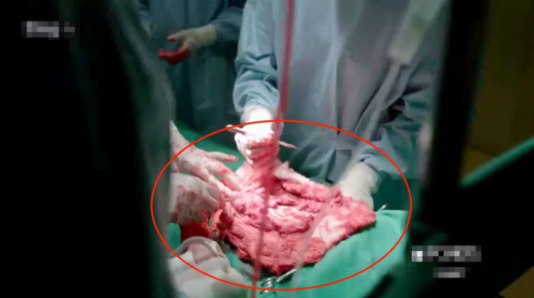 Những chi tiết vụng về trong "Hậu duệ Mặt Trời" khiến khán giả không thể bỏ qua ảnh 1