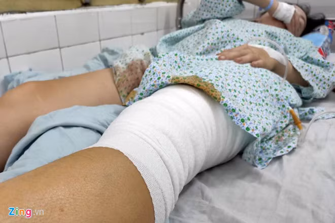 Vết thương của nữ CĐV Hà Nội đã được băng bó để chờ tiếp tục phẫu thuật. Ảnh: Mỹ Hà.