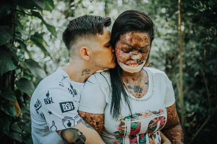 Chàng trai vẫn luôn nắm tay và ôm chặt cô gái dù cô có hình hài xấu xí đến thế nào.