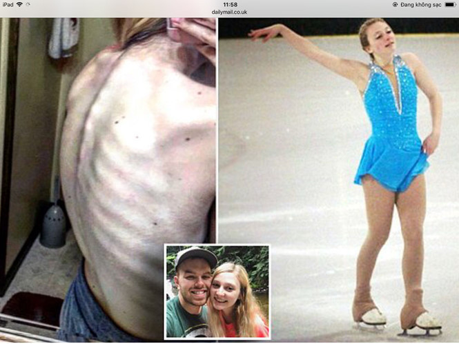 Nicole Rossi đã giảm gần 34 kg nhờ chế độ ăn “thực phẩm sạch”... ẢNH: CHỤP MÀN HÌNH DAILY MAIL.