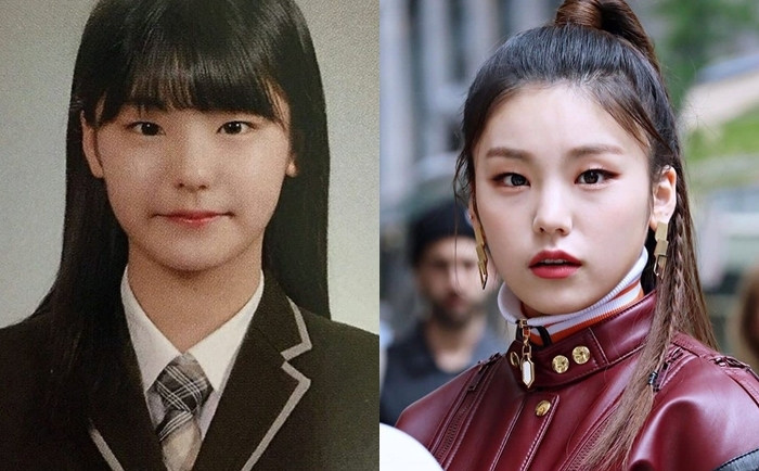 Yeji bị nghi ngờ phẫu thuật mũi