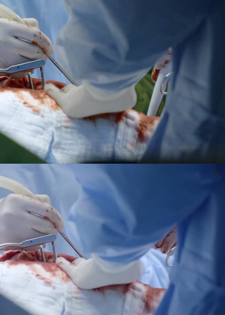 Trong một cảnh phẫu thuật, ekip làm phim sử dụng lại cảnh trong bản gốc.