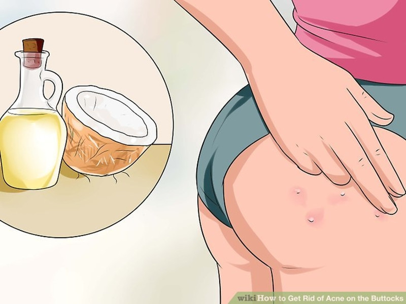 Góc dành riêng cho XX: Bí kíp “cứu rỗi” hai “nàng đào tiên” ảnh 2 Góc dành riêng cho XX: Bí kíp “cứu rỗi” hai “nàng đào tiên” ảnh 2