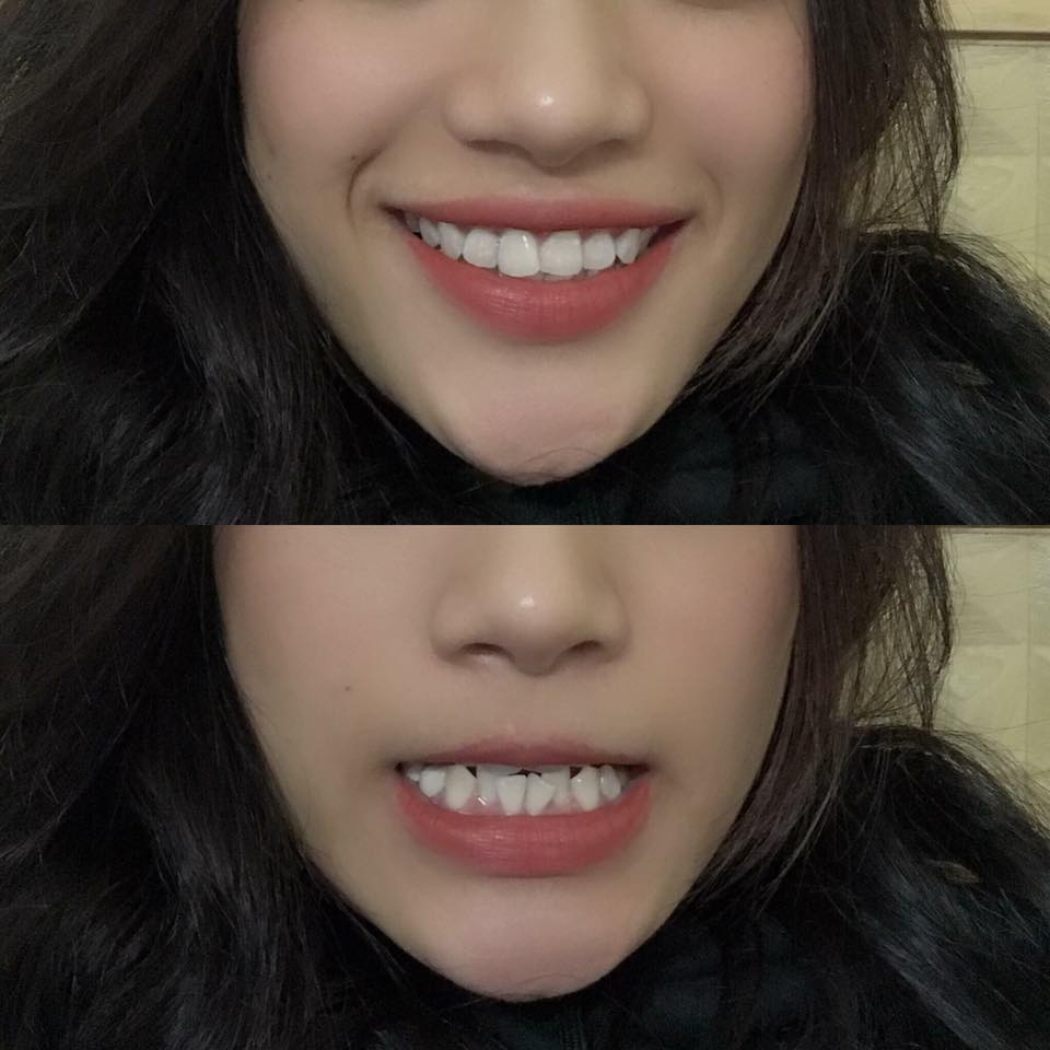 "Bất ngờ chưa!"