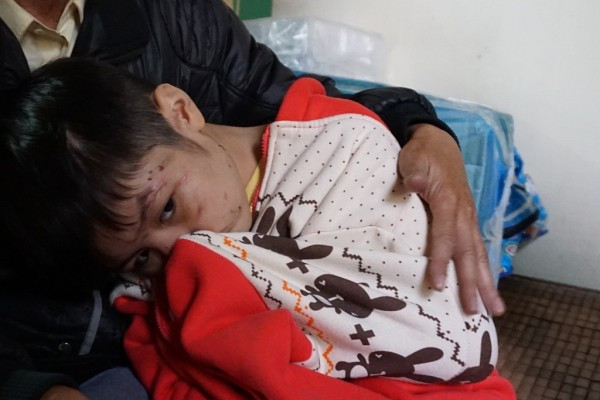 Bé trai 10 tuổi bị bạo hành gãy xương sườn, rạn sọ não vẫn xin tha tội cho bố ảnh 2 Bé trai 10 tuổi bị bạo hành gãy xương sườn, rạn sọ não vẫn xin tha tội cho bố ảnh 2