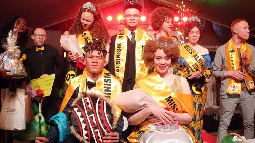 Ảnh: Dennis Onsongo.