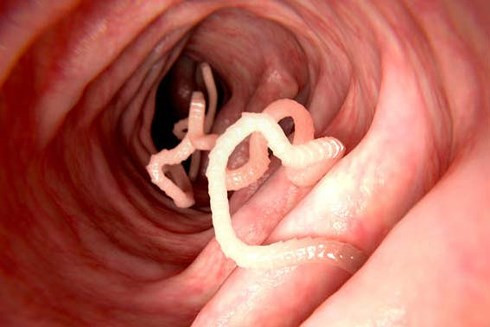 Sán gây 1.600 ca tử vong mỗi năm. Con người dễ bị nhiễm sán khi ăn các loại thịt chưa được nấu chín.