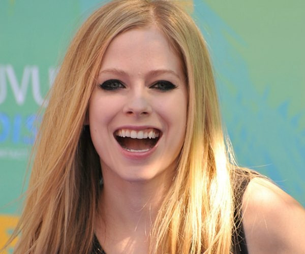 Ca sĩ Avril Lavigne cũng sở hữu hàm răng được ví như 