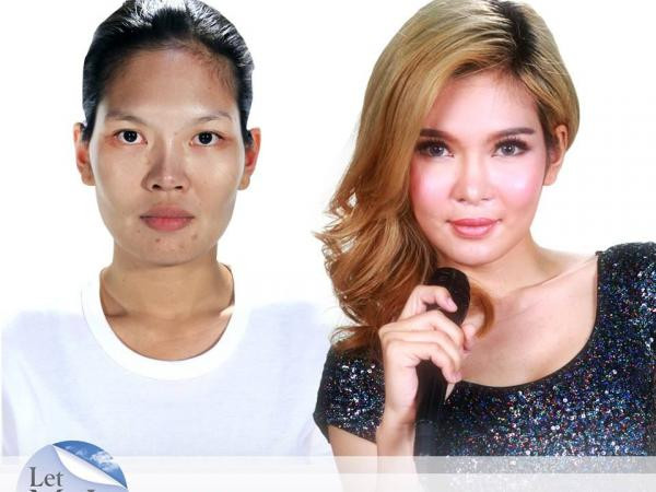 Phẫu thuật thẩm mỹ đã thay đổi số phận một người như thế nào? ảnh 7