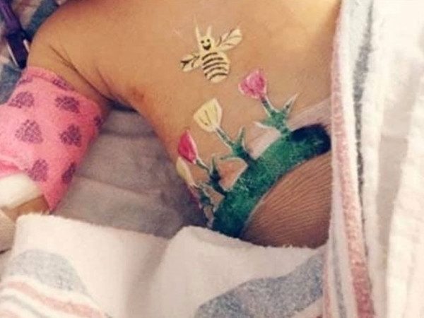 Bác Parry vẽ cả một vườn hoa lên băng vết thương của cô bé tên là Rose.