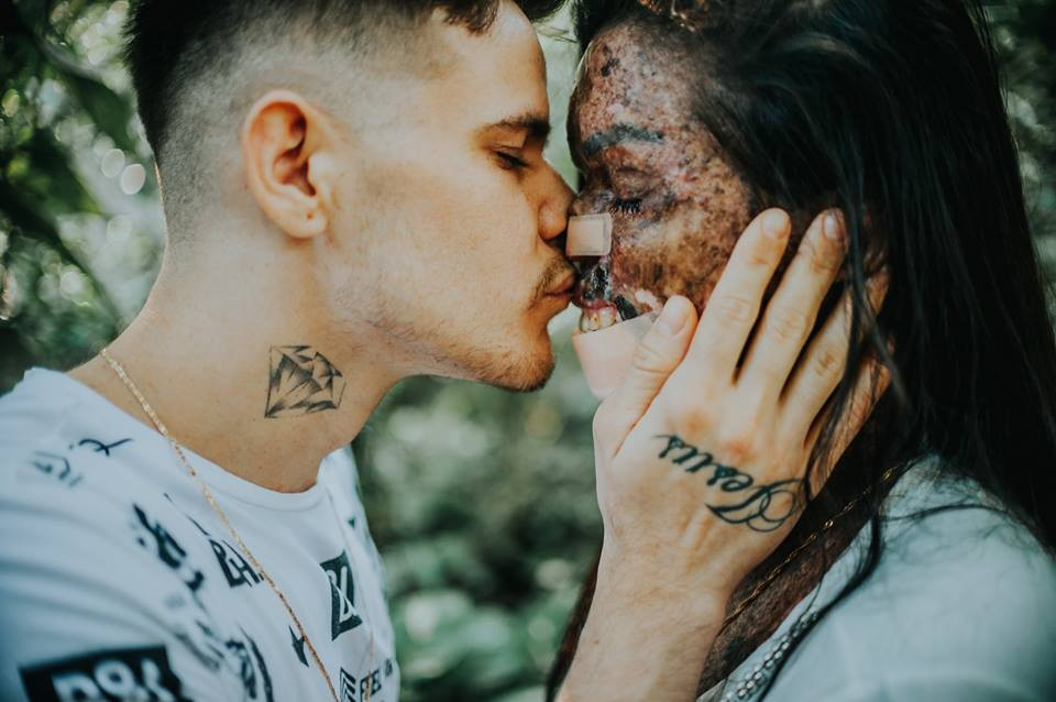 Ai cũng xúc động trước tình yêu đẹp và cao thượng của cặp đôi người Brazil.